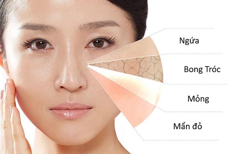 Bật mí 2 cách phân biệt các loại da đơn giản